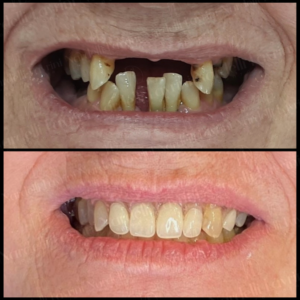 MODELOS Nardelli Lavrini Odontologia (1)