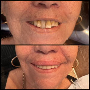 MODELOS Nardelli Lavrini Odontologia (2)