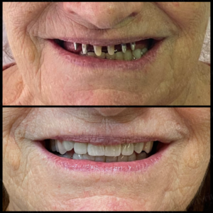 MODELOS Nardelli Lavrini Odontologia (3)