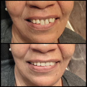 MODELOS Nardelli Lavrini Odontologia